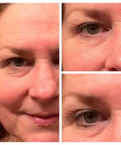 Vibriance Super C Serum for Mature Skin Made in the USA, All-In-One Formula Hydrates, Firms, Lifts, Targets Age Spots, Wrinkles, & Smooths Skin, The Original Serum - 1 fl oz (30 ml), Pack of 1 1 Fl Oz (Pack of 1) 35 61WhvBBcx7L