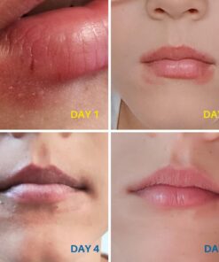 Dr. Dan's Cortibalm - 1 Pack - for Dry Cracked Lips - Healing Lip Balm for Severely Chapped Lips - Designed for Men, Women and Children 0.14 Ounce (Pack of 1) 35 61Wta447HrL