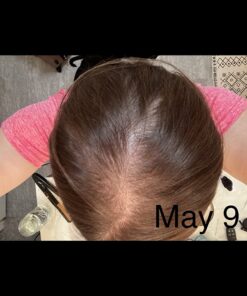 Sugarbear Hair Vitamins Extra Strength Biotin 6000mcg, Vitamin C, E, Coconut Oil, Zinc, Folic Acid, Inositol - Vegan Gummies for Luscious Hair and Nails - Supplement for Women & Men (1 Month Supply) 60 Count (Pack of 1) 33 61X2zkes3XL