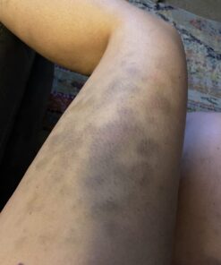 Coolife Fascia Muscle Roller - Cellulite Massager - Fascia Roller for Cellulite and Sore Muscles - Neck, Leg, Back, Body Roller Deep Tissue Massage Stick Tools - 3 Balls Size Version. Mint Green 43 61Xi5hvSB2L