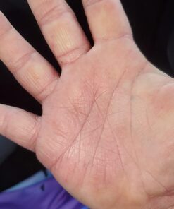 MG217 Multi Symptom Relief 2% Coal Tar Medicated Psoriasis Ointment oz Jar, 4 Oz 4 Ounce (Pack of 1) 37 61Xj7ANnTYL