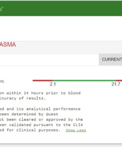 NOW Supplements, Vitamin B-6 (Pyridoxine HCl) 100 mg, Cardiovascular Health*, 250 Veg Capsules 250 Count (Pack of 1) 18 61XpHjxK4KL