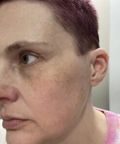 TruSkin Vitamin C Face Serum – Anti Aging Face & Eye Serum with Vitamin C, Hyaluronic Acid, Vitamin E – Brightening Serum, Dark Spot Remover, Even Skin Tone, Eye Area, Fine Lines & Wrinkles, 1 Fl Oz 1 Fl Oz (Pack of 1) 44 61Y IkXqN0L