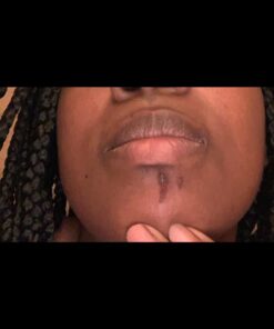 Active Skin Repair First Aid Scar Shield Hydrogel - Scar Treatment for Cuts, Scrapes, Burns and Other Wounds to Stop Scars BEFORE They Form - Natural and Non-Toxic Scar Prevention Gel (3 oz Gel) 27 61YCW5a9suL