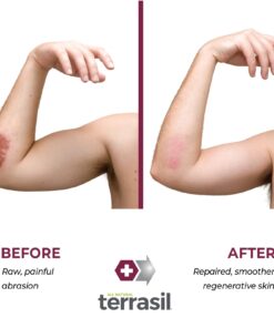 Terrasil Skin Repair Cream MAX, Natural Ingredients, Zinc Oxide Ointment for Folliculitis and Boil Symptoms, All Purpose First Aid Supplies, Anti Itch Cream, 50g 13 61Z5oYnapL