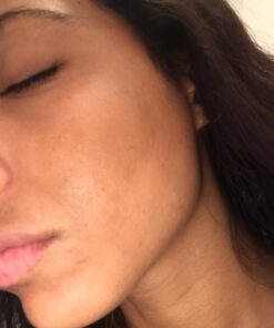 Kleem Organics Pure Vitamin C Serum for Face with Hyaluronic Acid & Vitamin E - Anti Aging Vitamin C Face Serum for Women to Boost Collagen, Reduce Wrinkle, Acne, Dark Spot & Sun Damage - Vit C Serum 1 Fl Oz (Pack of 1) 35 61Zn2xFycSL