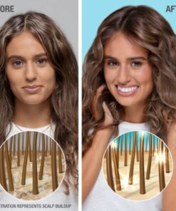 Neutrogena Moisturizing Healthy Scalp Hydro Boost Shampoo for Dry Hair and Scalp, with Hydrating Hyaluronic Acid, pH-Balanced, Paraben & Phthalate-Free, Color-Safe, 12 Fl Oz (pack of 3) 12 Fl Oz (Pack of 3) 12 61ZxRYSRzZL