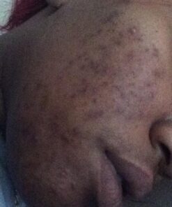 Nubian Heritage African Black Soap, 5 Ounce (Pack of 4) Tea Tree Oil Oats & Aloe 5 Ounce (Pack of 4) 20 61aPXzw8H L