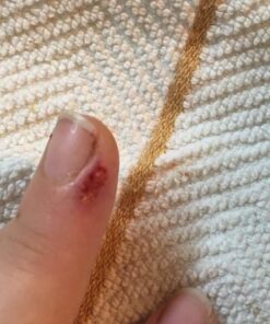 BerbereX Antimicrobial Wound Cleanser for Cuts, Scrapes, Burns, Incisions, Piercing Aftercare, Wounds, Wound Care, First Aid Antiseptic Antibacterial Spray, Pressure Sore, Diabetic Ulcer - 4oz 16 61aRez5mAL