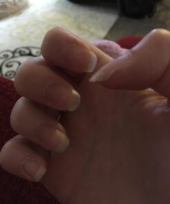 Bronson Ultra Biotin 10,000 Mcg Hair Skin and Nails Supplement, Non-GMO, 120 Vegetarian Capsules 120 Count (Pack of 1) 29 61aZsM1wkL