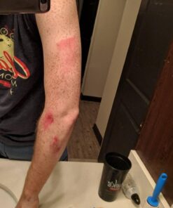 DuoDERM Extra Thin CGF Hydrocolloid 4"x4" Sterile Self-Adhesive Dressing for Management of Lightly Exuding Wounds, Flexible, Latex-Free, Beige, 187955, Box of 10 4x4 Inch (Pack of 10) 16 61ani7eH2gL