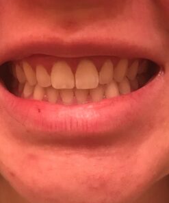 Active Wow Activated Coconut Charcoal Powder - Natural Whitening Activated Charcoal, Charcoal Vanilla Toothpaste, Fluoride Free, Sulfate & Paraben Free, Charcoal Toothpaste Powder (All Natural) All Natural 36 61awqMHCWNL