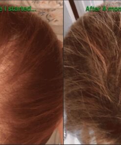 Newopure: Natural Hair Growth Vitamins, Repairs Hair Follicles, Stops Hair Loss, Blocks DHT, Stimulates New Hair Growth, Promotes Thicker, Fuller and Faster Growing Hair. Men & Women (30 Day Supply) 33 61axL UkPdL