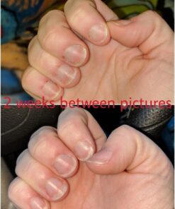 O'Keeffe's Working Hands Hand Cream, 3.4 oz., Jar, (Pack of 2) 3.4 Ounce (Pack of 2) 42 61b RMfjnmL