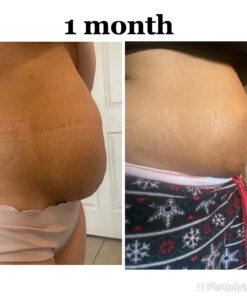 Nivea Skin Firming and Toning Body Gel Cream with Q10, Firming Body Cream, Moisturizing Skin Cream, 6.7 Oz Tube Skin Firming Gel 50 61bOsWSMg4L