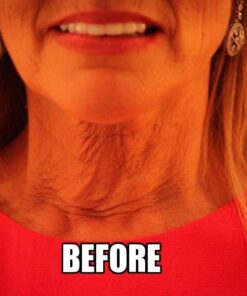 NeckTITE Magic - The Instant Neck Lift 12 Count (Pack of 1) 13 61bZAmB2N1L