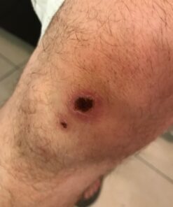 BerbereX Antimicrobial Wound Cleanser for Cuts, Scrapes, Burns, Incisions, Piercing Aftercare, Wounds, Wound Care, First Aid Antiseptic Antibacterial Spray, Pressure Sore, Diabetic Ulcer - 4oz 13 61bqzpwJw6L