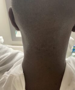 Molnlycke Hibiclens Solution, 8 Fl Oz (Pack of 1) 14 61c0VX3AfsL