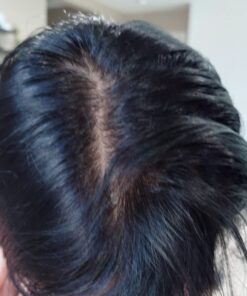 Neutrogena Scalp Therapy Anti-Dandruff Shampoo Daily Control, 1.8% salicylic acid, with fragrance of warm vanilla & toasted coconut notes, 12 fl oz 43 61c0j3gLkpL