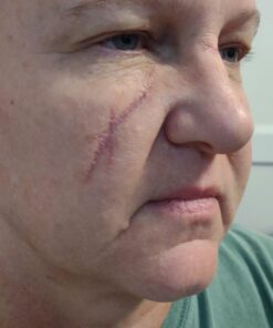 Mehron Makeup Rigid Collodion with Brush | Scarring Liquid | Scar Liquid | Liquid Scar Makeup | SFX Scar Makeup for Film .125 oz (4ml) 37 61ccA7VUvUL