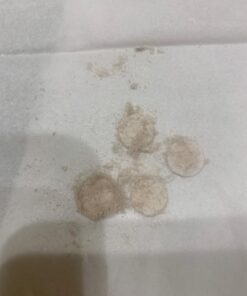 Kendal Professional Diamond Microdermabrasion Machine, Dermabrasion Facial Skin Care Equipment, Also Good for Home Use AC 110V HB-SF01 50 61ckgeI7h7L