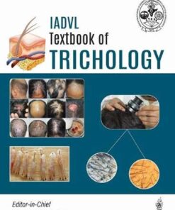 IADVL Textbook of Trichology