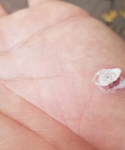 Compound W Dual Power for Large Warts, Freeze Off & Liquid Wart Remover, 8 Freeze Applications and 12 Comfort Pads 24 61d0R30YkzL 2