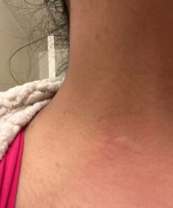 Sallye Ander "No-Bite-Me" All Natural Bug Repellent & Insect Repellent - Anti Itch Cream - Safe for Kids and Infants - Repels Mosquitoes, Fleas, and Ticks - 2 oz - Organic Bug Repellent for Skin 2 Ounce (Pack of 1) 51 61dCv36LKL