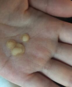 Nexcare Acne Cover, Skin Cover Absorbs Pus and Oil From Clogged Pores, Suitable Skincare for Most Skin Types - 36 Acne Covers 36 Count (Pack of 1) 51 61dJJILT4UL