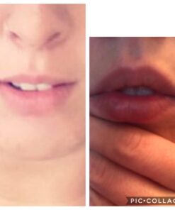 Fullips Lip Plumper Tool - Medium Oval with Bonus Large Round Enlarger - Self Suction Plumping Device For Fuller Lips - Plump in Seconds - Natural Instant Lip Enhancement Kit - Red Plastic Plumpers 58 61dSEi0yLiL