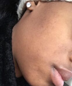 Viva Naturals Jojoba Oil Organic Cold Pressed Unrefined - 100% Pure Jojoba Oil for Skin, Natural Face Moisturizer and Hair Moisturizer, USDA Certified Organic Face Oil for Skin Care DIY, 4 fl. oz 4 Fl Oz (Pack of 1) 60 61dcmv0NqL