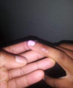 Compound W One Step Wart Remover Strips for Kids, 10 Medicated Strips for Wart Removal, 2 Pack unflavored 10 Count (Pack of 2) 53 61dfh1zFBrL