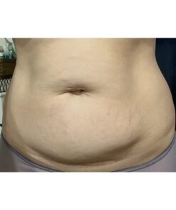 Nivea Skin Firming and Toning Body Gel Cream with Q10, Firming Body Cream, Moisturizing Skin Cream, 6.7 Oz Tube Skin Firming Gel 46 61dx0 laDeL