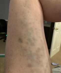 Coolife Fascia Muscle Roller - Cellulite Massager - Fascia Roller for Cellulite and Sore Muscles - Neck, Leg, Back, Body Roller Deep Tissue Massage Stick Tools - 3 Balls Size Version. Mint Green 41 61f8ghsgOML