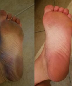 Amope Pedi Perfect Electronic Foot File, Dual-Speed Callus Remover (with Diamond Crystals) for Feet (Extra Coarse - Pink Gadget). -Perfect for In-home Pedicure for Baby Smooth Feet. Battery Operated 49 61fEUEe9JdL