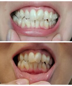 Sensodyne Extra Whitening Sensitive Teeth Whitening Toothpaste - 4 Ounces (Pack of 3) 25 61fGYSYK1iL