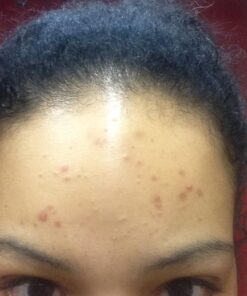 Lily of the Desert Aloe Vera Gel 32 oz 32 Fl Oz (Pack of 1) 34 61fGZPmKncL