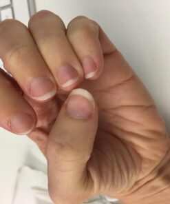 vitafusion Extra Strength Biotin Gummy Vitamins, Berry Flavored, 5,000 mcg Biotin Vitamins, America’s Number 1 Gummy Vitamin Brand, 50 Day Supply, 100 Count (Packaging may vary) 60 61fZKStuw4L