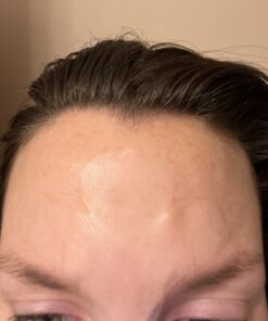 Toute Nuit Wrinkle Patches, Face Tape, Jet - Extra Large UNISEX Frown Lines Plus and Forehead - 20 Patches 20 61frurWHg L