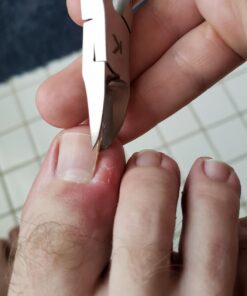 KOHM Ingrown Toenail Clippers for Thick Nails - 5" Long KP-700 Heavy Duty Stainless Steel Toe Nail Nippers Tool for Men, Women, Seniors & Adults - Professional Podiatrist Tool 3 Piece Set 48 61g zC0UAvL
