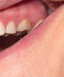 TheraBreath Healthy Gums Mouthwash, Clean Mint, Antigingivitis, Dentist Formulated, 16 Fl Oz (2-Pack) 16 Fl Oz (Pack of 2) 33 61gF0H4iMiL