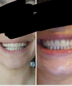 Large 12 Oz. Coconut Activated Charcoal Powder. Whitens Teeth, Rejuvenates Skin and Hair, Supports Better Digestion. USA-Owned Producers, Free Scoop 12 Ounce (Pack of 1) 25 61gGDiqHP1L