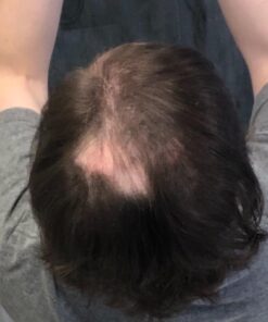 XFusion Keratin Hair Fibers - Black (Large Size 28g) Medium Brown 34 61gTgmQ1B6L