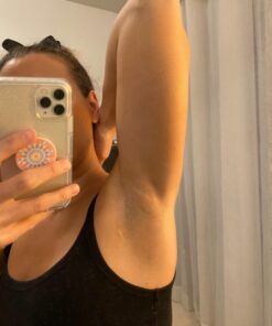 Tea Tree Oil Balm , Extra Strength, Pair Well with Jock Itch Cream, Spray, Athletes Foot, Ringworm Cream for Human, Fast Acting for Dry, Itchy Skin, Plant Powered Wonder Balm 35 61gwJfft6NL