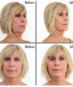 Bring It Up Instant Face Lift Tape Kit: 30-Day Supply, Transparent Neck & Eyebrow Lift Strips, Anti-Wrinkle Stickers 12 61hf6I4OSaL