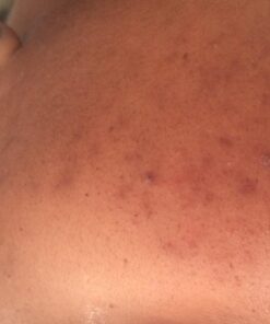 Nubian Heritage African Black Soap, 5 Ounce (Pack of 4) Tea Tree Oil Oats & Aloe 5 Ounce (Pack of 4) 21 61hsVXOlocL