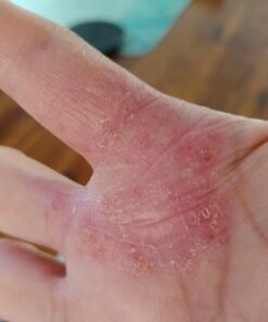 Moisturising Cream, Body and Face Moisturizer for Dry Skin, Acne Cream, 2PC 0.53 Ounce (Pack of 1) 48 61iolzE0RoL