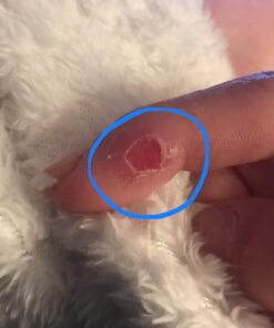 Compound W Wart Remover Maximum Strength One Step Pads, 14 Medicated Pads 14 Count (Pack of 1) 47 61jq81BlxEL