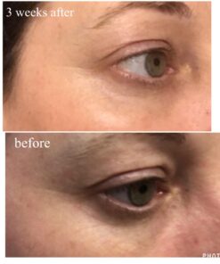 L’Oréal Paris Age Perfect Eye Renewal Cream, 0.5 fl oz - Anti-Aging for Mature Skin 20 61jyVjSjriL