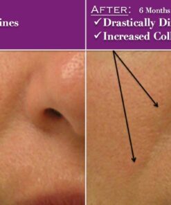 PUREST Natural & Organic Hyaluronic Acid with Vitamin C and E - WRINKLE ERASER & Collagen Builder. 14 61k3ZegTULL 1